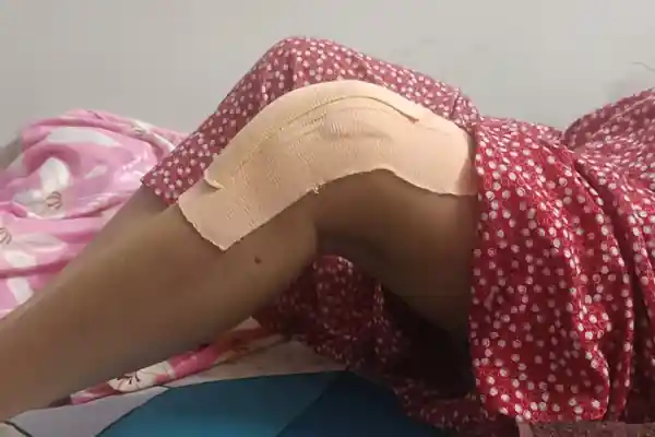 Knee rehabilitation treatment with the patient’s face cropped out